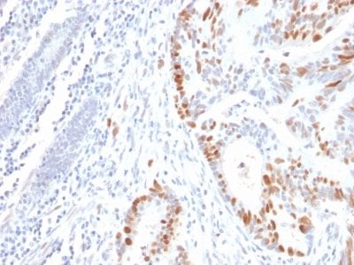 p53 Tumor Suppressor Recombinant Monoclonal Mouse Antibody (rBP53-12)
