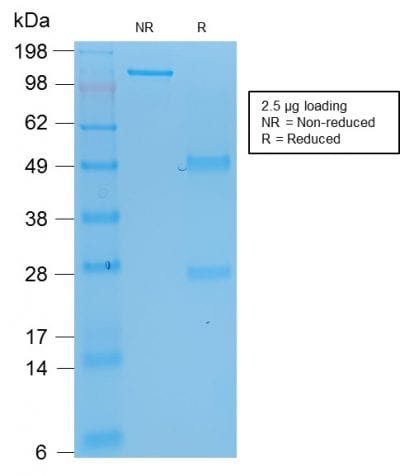 p53 Tumor Suppressor Recombinant Monoclonal Mouse Antibody (rBP53-12)