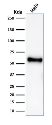 p53 Tumor Suppressor Recombinant Monoclonal Mouse Antibody (rBP53-12)