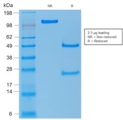 p53 Tumor Suppressor Recombinant Monoclonal Mouse Antibody (rTP53/1739)