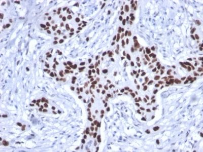 p53 Tumor Suppressor Recombinant Monoclonal Mouse Antibody (rTP53/1739)