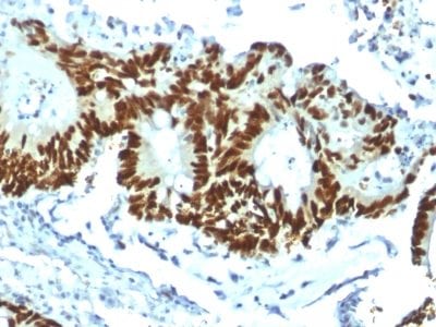 p53 Tumor Suppressor Recombinant Monoclonal Rabbit Antibody (Tp53/1799R)