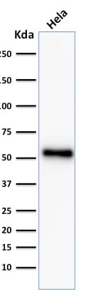 p53 Tumor Suppressor Recombinant Monoclonal Rabbit Antibody (TP53/2092R)