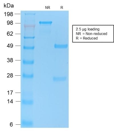 p53 Tumor Suppressor Recombinant Monoclonal Rabbit Antibody (TP53/2092R)