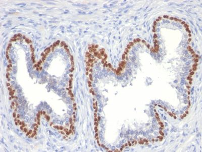 p63 Monoclonal Mouse Antibody (TP63/11)