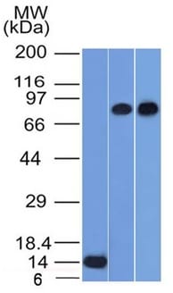 p63 Monoclonal Mouse Antibody (TP63/1786)