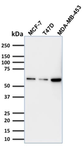 p63 Monoclonal Mouse Antibody (TP63/1786)
