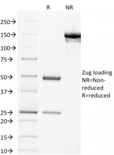 p63 Monoclonal Mouse Antibody (TP63/1786)