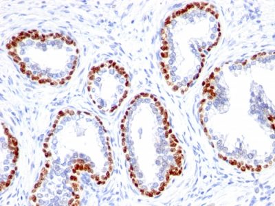 p63 Monoclonal Rabbit Antibody (TP63/1423R)