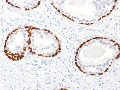p63 Polyclonal Rabbit Antibody