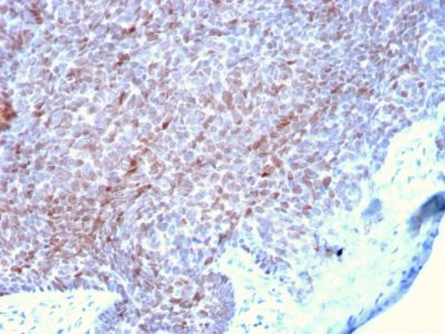 p73 Monoclonal Mouse Antibody (P73/2531)