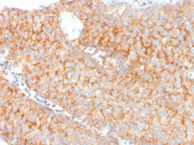 PAI-RBP1 / SERBP1 / SERPINE1 Monoclonal Mouse Antibody (SERBP1/3491)