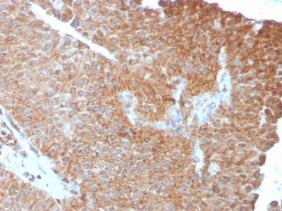 PAI-RBP1 / SERBP1 / SERPINE1 Monoclonal Mouse Antibody (SERBP1/3493)