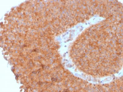 PAI-RBP1 / SERBP1 / SERPINE1 Monoclonal Mouse Antibody (SERBP1/3495)