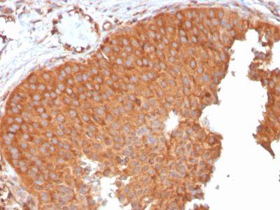 PAI-RBP1 / SERBP1 / SERPINE1 Monoclonal Mouse Antibody (SERBP1/3496)