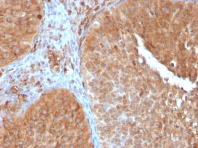PAI-RBP1 / SERBP1 / SERPINE1 Monoclonal Mouse Antibody (SERBP1/3497)