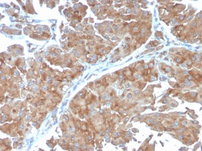PAI-RBP1 / SERBP1 / SERPINE1 Monoclonal Mouse Antibody (SERBP1/3498)