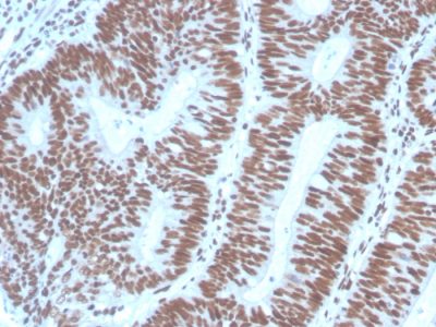 PAX2 Monoclonal Mouse Antibody (PAX2/1104)