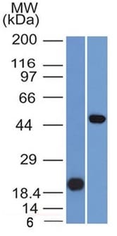 PAX8 Monoclonal Mouse Antibody (PAX8/1491)