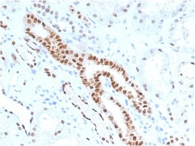 PAX8 Monoclonal Mouse Antibody (PAX8/1491)