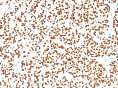 PAX8 Monoclonal Mouse Antibody (PAX8/1491)