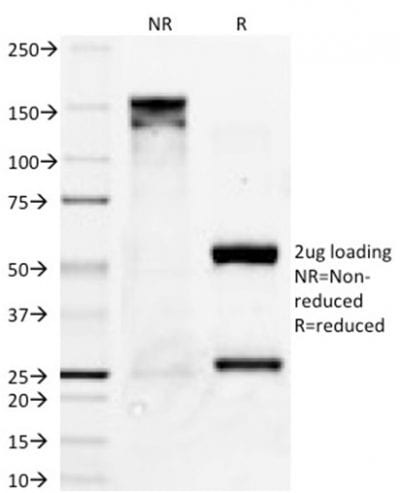 PAX8 Monoclonal Mouse Antibody (PAX8/1491)