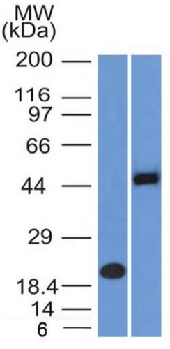 PAX8 Monoclonal Mouse Antibody (PAX8/1492)