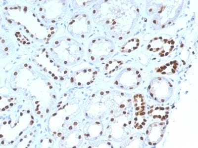 PAX8 Monoclonal Mouse Antibody (PAX8/1492)