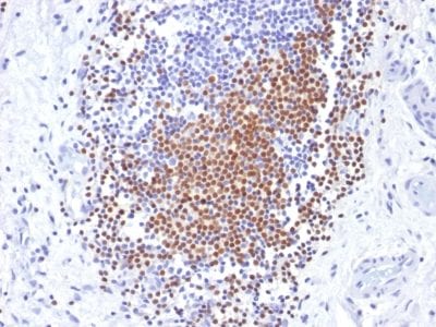 PAX8 Monoclonal Mouse Antibody (PAX8/1492)