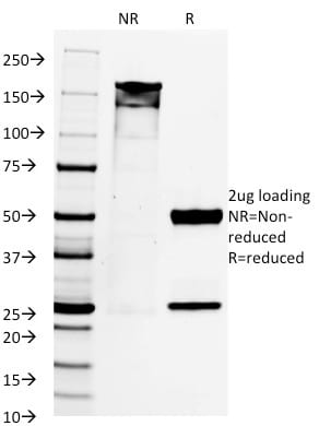 PAX8 Monoclonal Mouse Antibody (PAX8/1492)