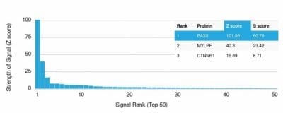 PAX8 Monoclonal Mouse Antibody (PAX8/1492)