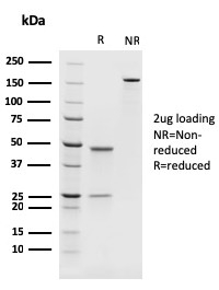 PAX8 Recombinant Monoclonal Mouse Antibody (rPAX8/1492)