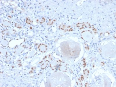 PAX8 Recombinant Monoclonal Rabbit Antibody (PAX8/2774R)