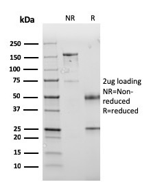 PD-L1 / PDCD1LG1 / CD274 / B7-H1 Monoclonal Mouse Antibody (PDL1/2745)