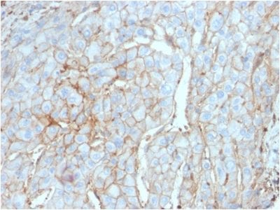 PD-L1 / PDCD1LG1 / CD274 / B7-H1 Monoclonal Mouse Antibody (PDL1/2746)