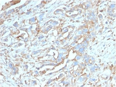 PD-L1 / PDCD1LG1 / CD274 / B7-H1 Monoclonal Mouse Antibody (PDL1/2746)