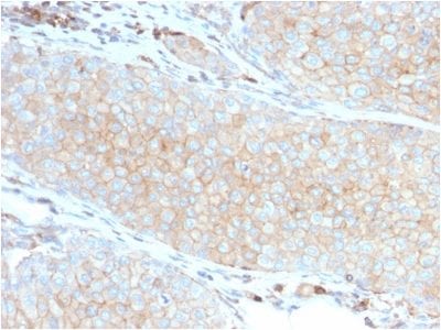 PD-L1 / PDCD1LG1 / CD274 / B7-H1 Monoclonal Mouse Antibody (PDL1/2746)