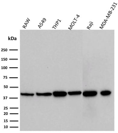 PD-L1 / PDCD1LG1 / CD274 / B7-H1 Monoclonal Mouse Antibody (PDL1/2746)