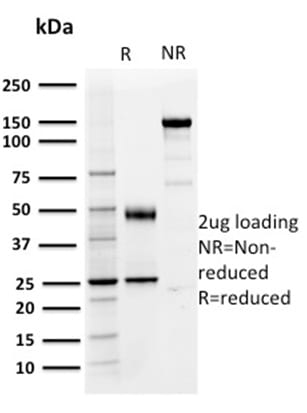 PD-L1 / PDCD1LG1 / CD274 / B7-H1 Monoclonal Mouse Antibody (PDL1/2746)