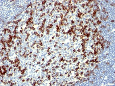 PD1 / PDCD1 / CD279 Monoclonal Mouse Antibody (NAT105)