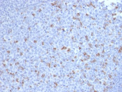 PD1 / PDCD1 / CD279 Monoclonal Mouse Antibody (PDCD1/2720)