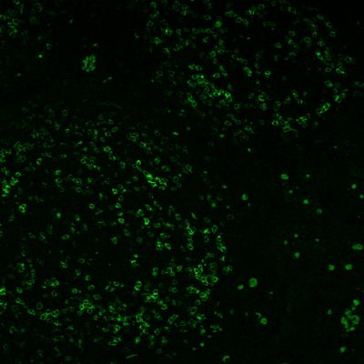 PD1 / PDCD1 / CD279 Monoclonal Mouse Antibody (PDCD1/922)