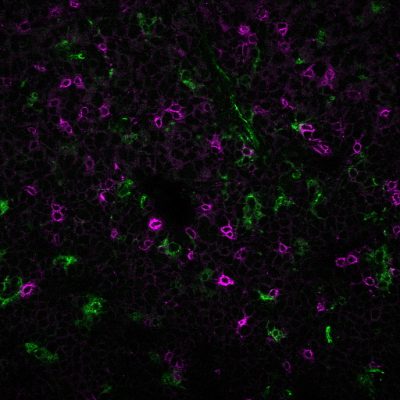 PD1 / PDCD1 / CD279 Monoclonal Mouse Antibody (PDCD1/922)