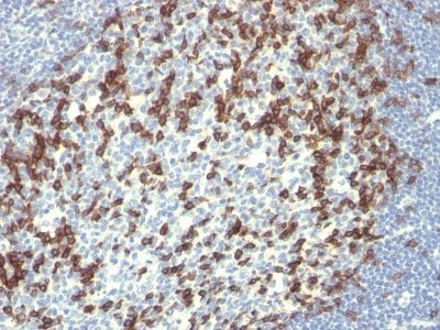PD1 / PDCD1 / CD279 Monoclonal Mouse Antibody (PDCD1/922)