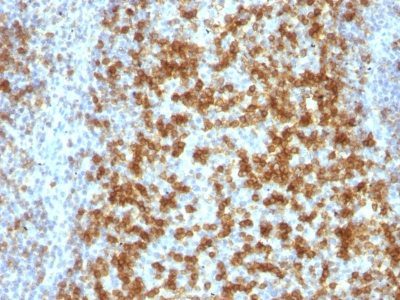 PD1 / PDCD1 / CD279 Monoclonal Mouse Antibody (PDCD1/922)
