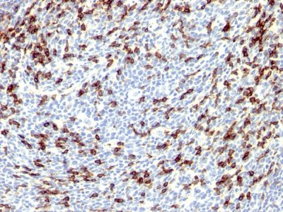 PD1 / PDCD1 / CD279 Polyclonal Rabbit Antibody