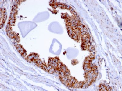PMEPA1 / TMEPAI Monoclonal Mouse Antibody (PMEPA1/2696)