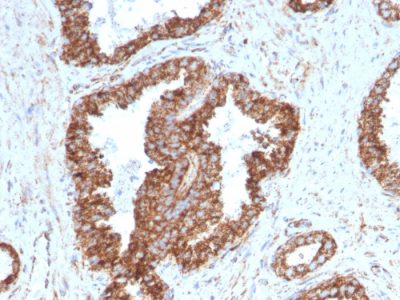 PMEPA1 / TMEPAI Monoclonal Mouse Antibody (PMEPA1/2698)
