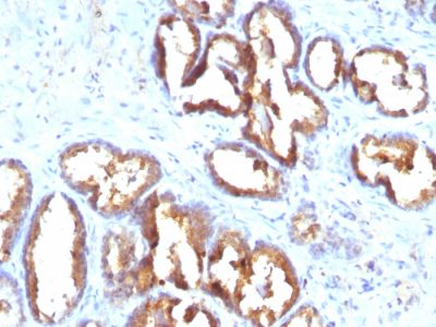 Prostate Specific Acid Phosphatase Monoclonal Mouse Antibody (PASE/4LJ)