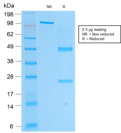 Prostate Specific Acid Phosphatase Recombinant Monoclonal Mouse Antibody (rACPP/1338)